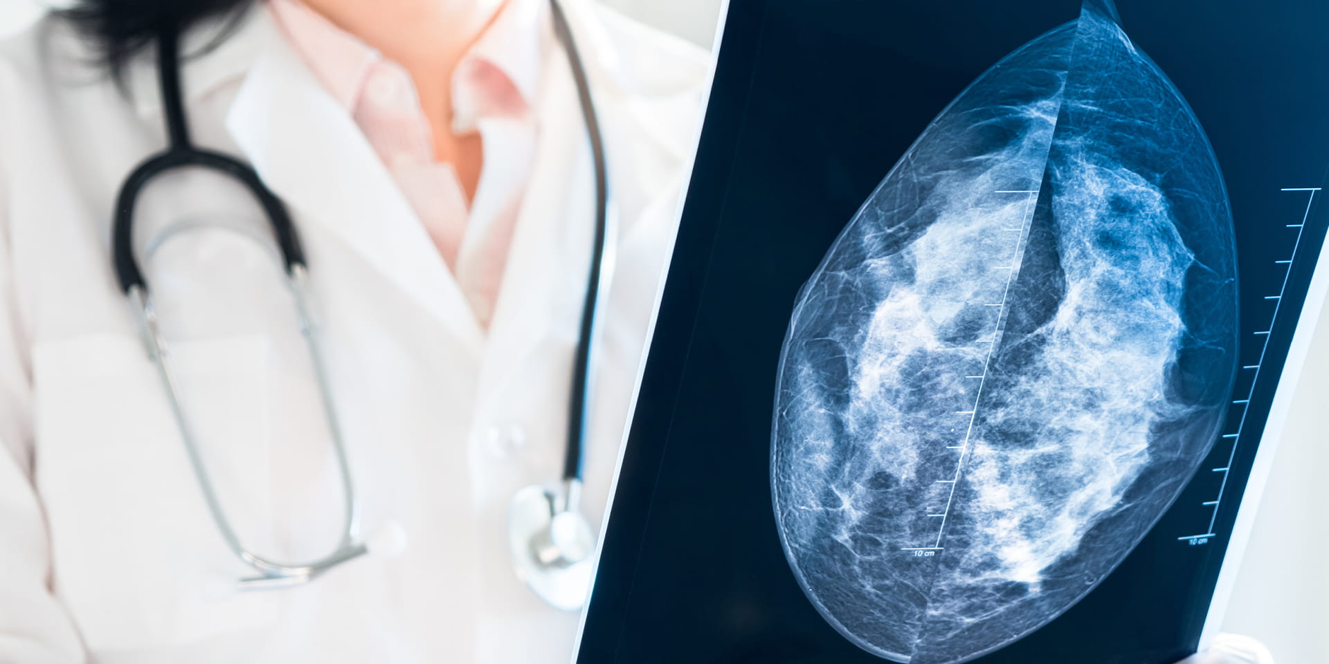 Doctor holding mammography film